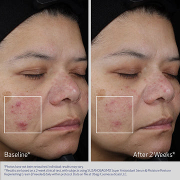 SUZANOBAGIMD­® Super Antioxidant Serum 30ml