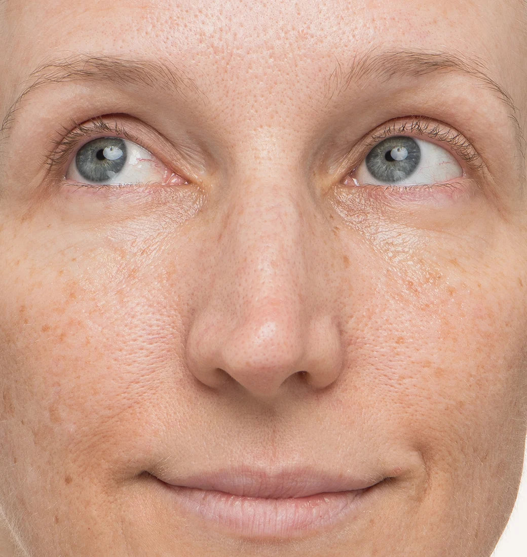 Immediately After 1 Application^