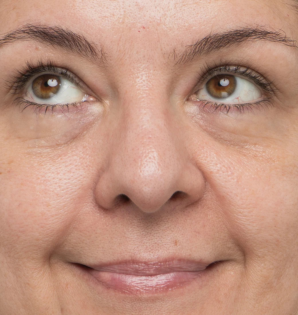 Immediately After 1 Application^