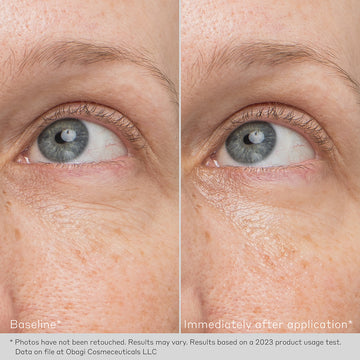 Daily Hydro-Drops® Rejuvenating Eye Gel Cream 15ml